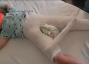 Pamjet makabre vërtetojnë se edukatorja ia theu këmbën 3-vjeçares në kopsht