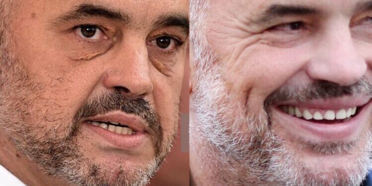 Edi Rama ka bërë ndërhyrje estetike?! Mjekja nxjerr të vërtetën…