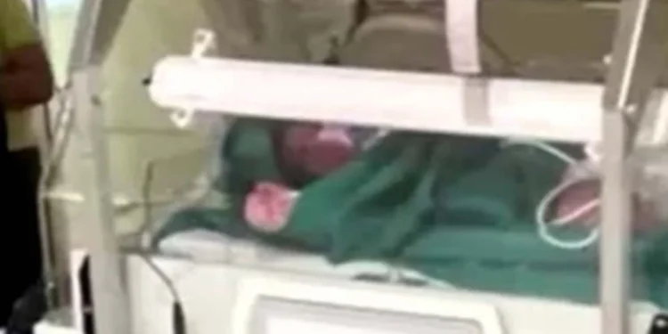Rekord/ Lind fëmija me peshë mbi 7 kg. Në gjendje të rënduar në spital pasi…