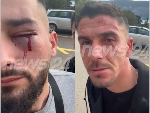 Dhuna në Malin e Zi/ “Kishim flamurin shqiptar në pasqyrën e automjetit”, zbardhet dëshmia e Klodian Meajt: Sapo dolëm nga makina na goditën dhe…