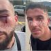 Dhuna në Malin e Zi/ “Kishim flamurin shqiptar në pasqyrën e automjetit”, zbardhet dëshmia e Klodian Meajt: Sapo dolëm nga makina na goditën dhe…