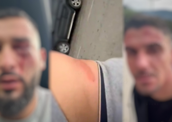 Dhuna ndaj 3 shqiptarëve në Malin e Zi/ “Ishte nisur për në Gjermani”, dëshmon familjari i Doris Kopaçit: Kishte refuzuar të dilte nga makina, por…