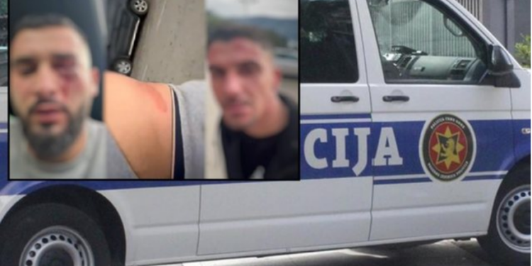 Dhunimi i 3 të rinjve në Malin e Zi/ “Sulm i qëllimshëm, jo incident banal”, kreu i Unionit Demokratik shqiptar: 3 militantë serbë janë arrestuar