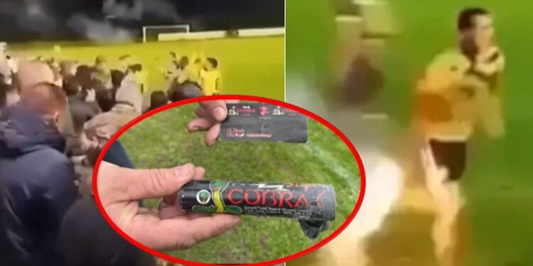 VIDEO/ Futbollisti humbet gishtat në fushë