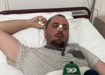 Dhunuan efektivin e policisë në Vlorë, procedohen babë e bir