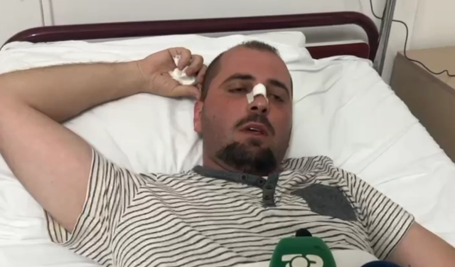 Dhunuan efektivin e policisë në Vlorë, procedohen babë e bir