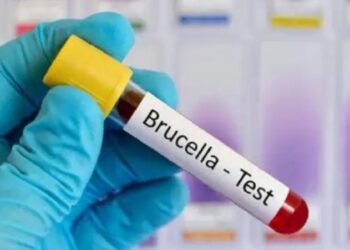 11 persona të prekur nga bruceloza