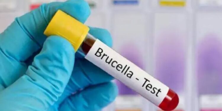 11 persona të prekur nga bruceloza