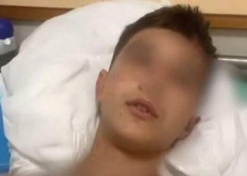 “Shkova për ta mbrojtur Martinin por një burrë më kapi,” flet për herë të parë nga spitali Luis Meçe