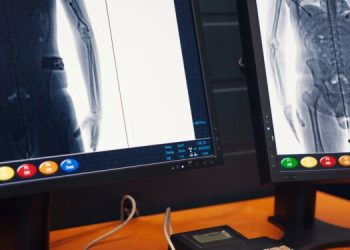 Tenderi 6.2 mln euro i sigurisë në burgje kthehet në mollë sherri në KPP, akuza për favorizim të AlbaScan dhe Advanced Business Solutions