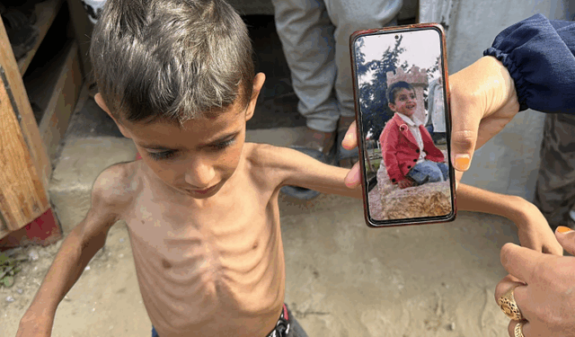 UNRWA jep alarmin: Trefishohet numri i fëmijëve të kequshqyer në Gaza