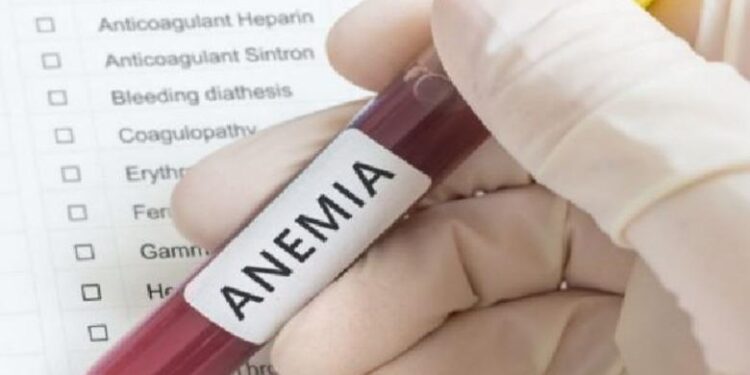 25% e grave nga 15 deri 49- vjeç në Shqipëri vuajnë nga anemia, përkeqësim në dekadën e fundit