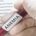 25% e grave nga 15 deri 49- vjeç në Shqipëri vuajnë nga anemia, përkeqësim në dekadën e fundit