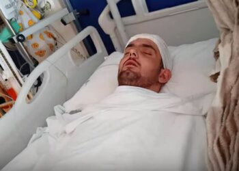 Kërkohet ndihmë për Klevisin, 22-vjeçari me tumor në kokë në luftë për jetën