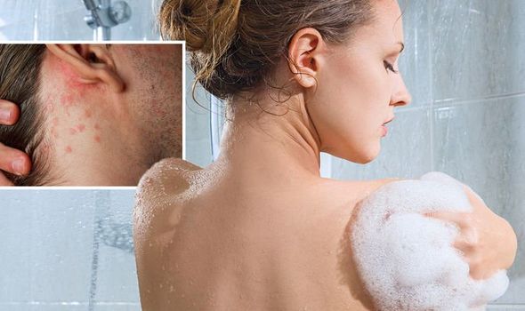 Dermatologët: Dushi i përditshëm mund të shkaktojë dëme serioze në lëkurë