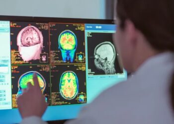 Adoleshenca zgjat deri në të 30-at, studimi i ri identifikon katër mosha kyçe të zhvillimit të trurit