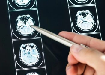 Një në tre shqiptarë vuan nga sëmundjet e sistemit nervor