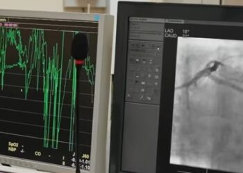 I ftohti rrit infarktet/ Mjekët apel qytetarëve: Mos i neglizhoni këto shenja