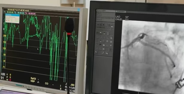 I ftohti rrit infarktet/ Mjekët apel qytetarëve: Mos i neglizhoni këto shenja