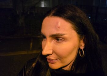 Lëndohet në kokë ish-kandidatja për deputete e PD: U qëllova nga tarraca e kryeministrisë