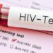 Raporti i HIV 2025: Shqipëria përballë një vale të re infeksionesh, rekord që nga 2016-a