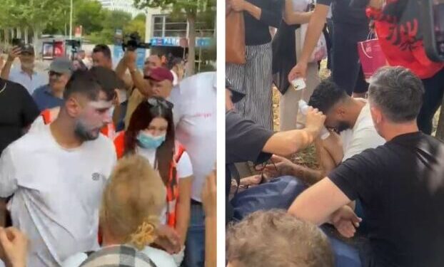 Spraj dhe piper drejt protestuesve, përfundon në ambulancë njëri prej tyre