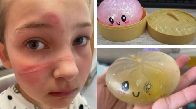 Alarmi për lodrat “Squishy”, mijëra tërhiqen nga tregu! Rrezik për lëndime serioze dhe vdekje te fëmijët