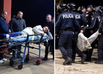 19-vjeçari me këmbën e thyer/ Pezullohen 4 policë dhe shefi i Rendit në Komisariatin nr. 1