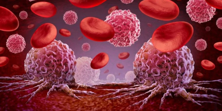 A mund të ndihmojë vitamina C në parandalimin e leuçemisë?