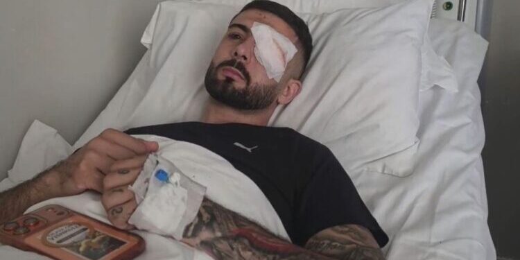 Erjon Vishkulli rrëfen momentin kur u qëllua me plumb gome në sy