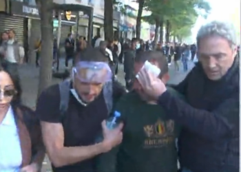 Lëndohet një protestues, deputeti demokrat i vjen në ndihmë