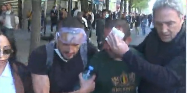 Lëndohet një protestues, deputeti demokrat i vjen në ndihmë